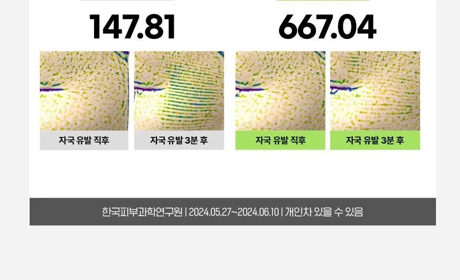 [콜라겐/레티놀]아이디얼 포 맨 퍼펙트 탄력 스킨 200mL 상세페이지 13